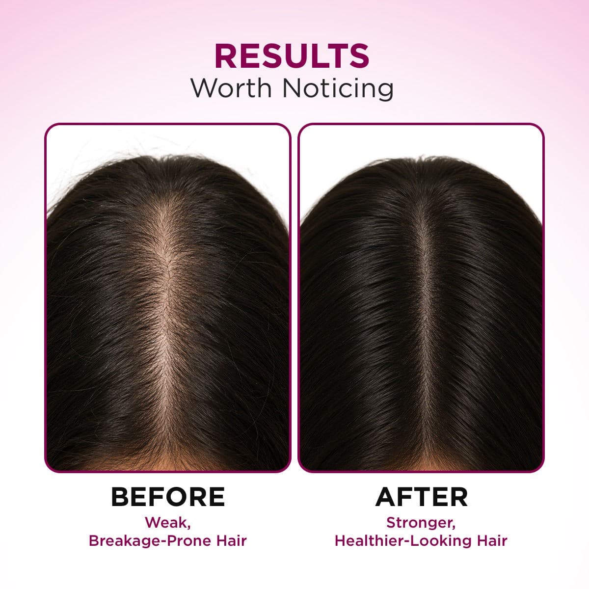 Hair Fall Control Shampoo with Pea Protein & Caffeine for Stronger Hair - 300 ml